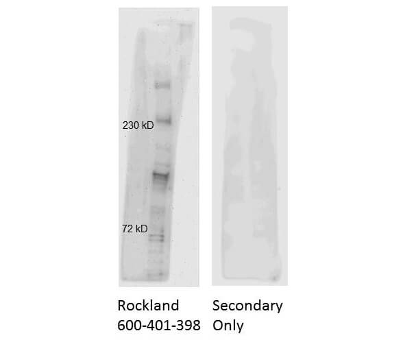 Anti ATM Antibody Western blot