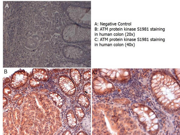 Immunohistochemistry of Anti-ATM Antibody