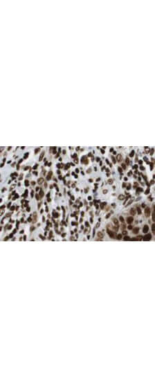 Anti-HDAC-1 Antibody - Immunohistochemistry