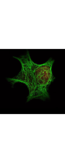 Anti HDAC-1 polyclonal antibody-Immunofluorescence Microscopy