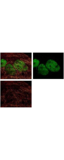 Immunofluorescence Microscopy – HDAC Antibody