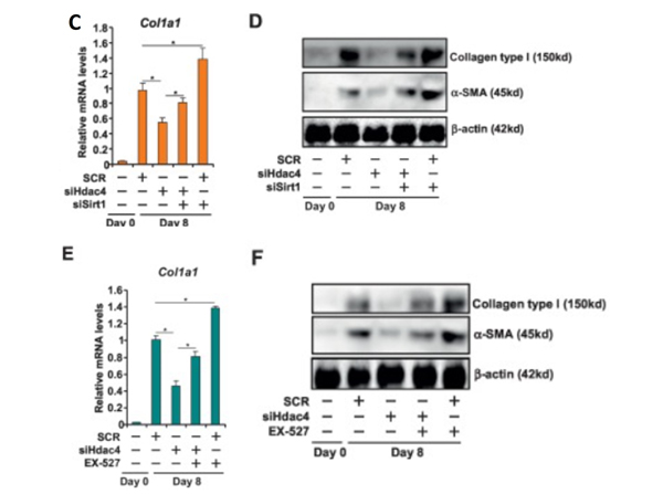 qPCR and Western Blot of Anti-Collagen Type I