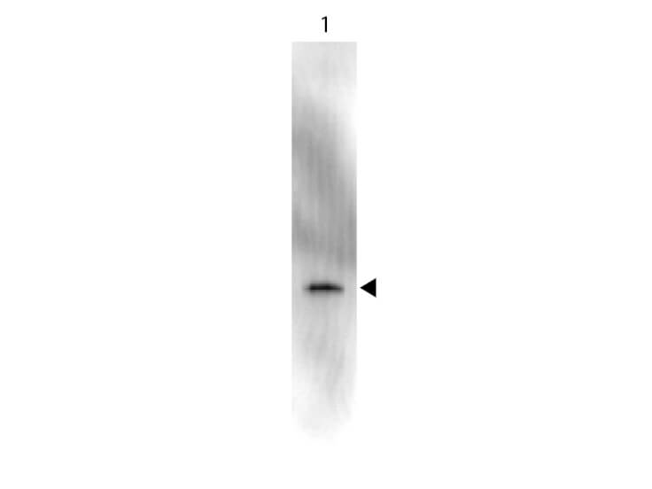 Peroxidase - Western Blot