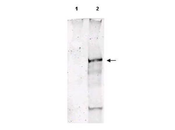Anti-ATM pS1981 Antibody - Western Blot