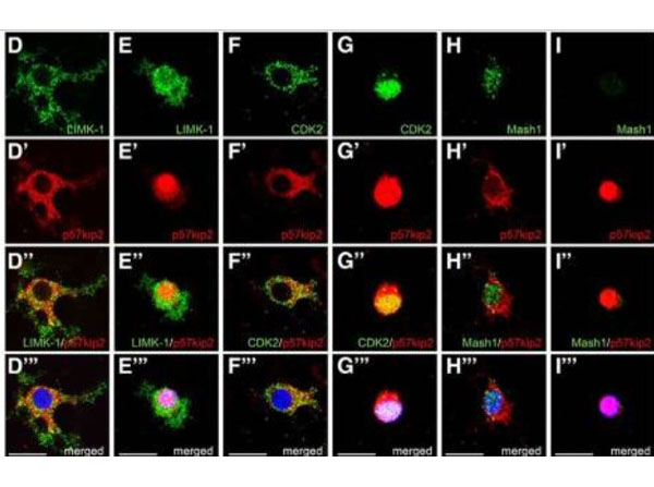Chicken IgG (H&L) Antibody DyLight™ 405 Conjugated Pre-Adsorbed