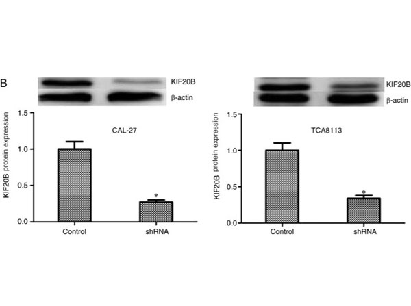 Western Blot results using Goat F(ab')2 Anti-Rabbit IgG Antibody