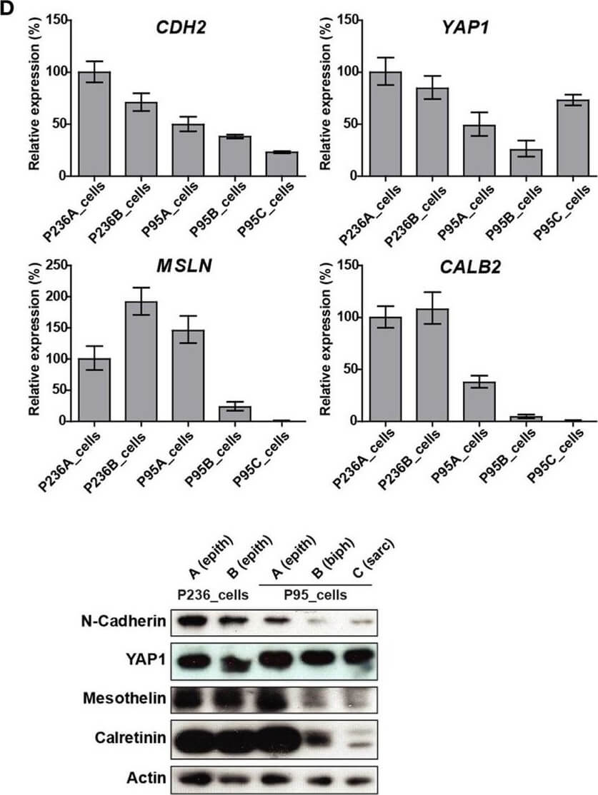 Western Blot of Anti-Mesothelin