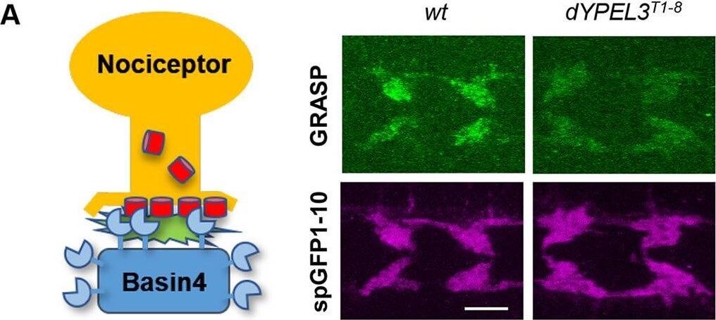 Immunofluorescence of Anti-RFP mx3