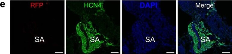 Immunohistochemistry of Anti-RFP