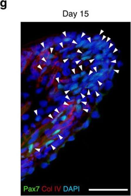 Immunohistochemistry of Anti-Collagen Type IV
