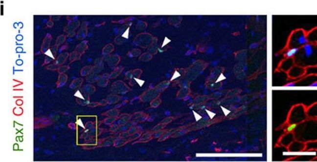 Immunohistochemistry of Anti-Collagen Type IV