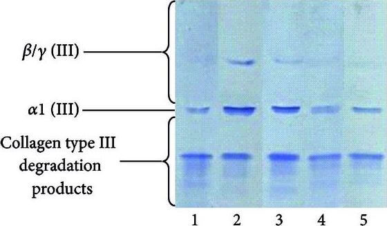 Western Blot of Anti-Collagen Type III