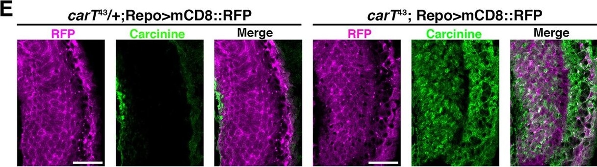 Immunohistochemistry of Anti-RFP