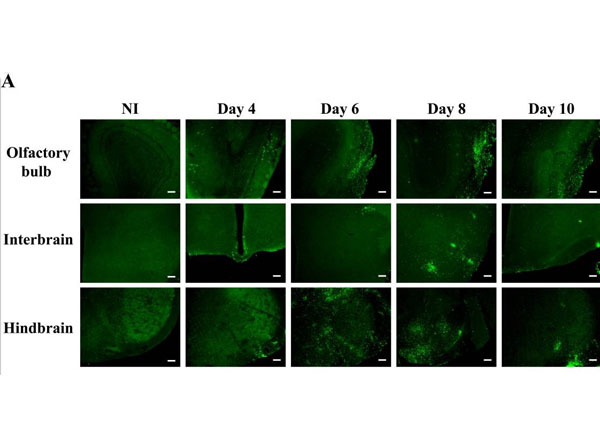 Immunohistochemistry using Chicken Serum