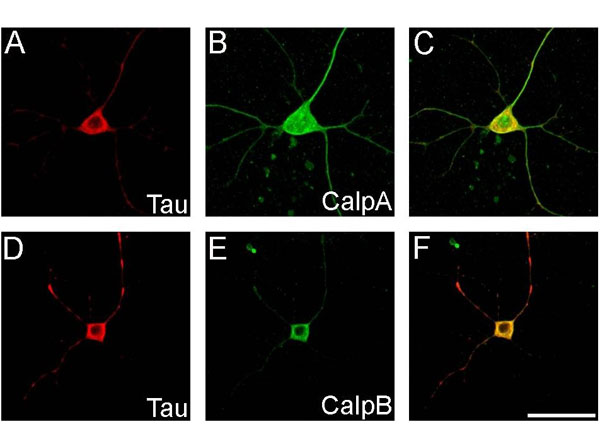 Immunohistochemistry using Goat Serum