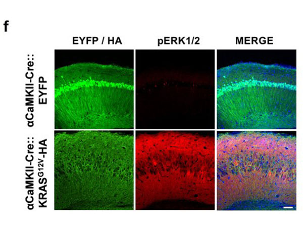 Immunohistochemistry using Goat Serum