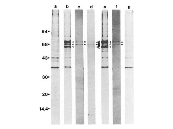 Immunoprecipitation using Guinea Pig Serum