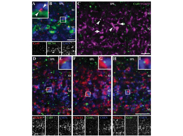 Immunofluorescence using Donkey Serum