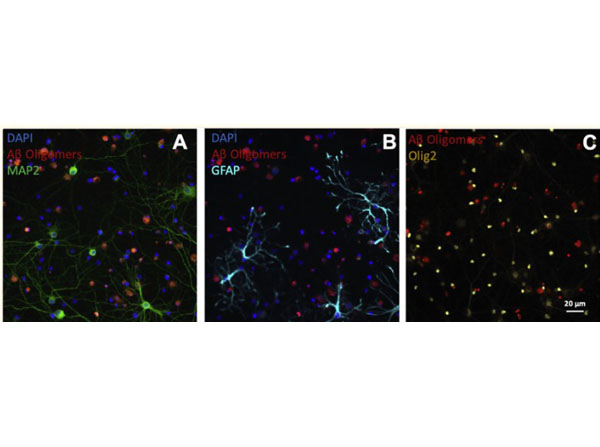 Immunofluorescence using Donkey Serum