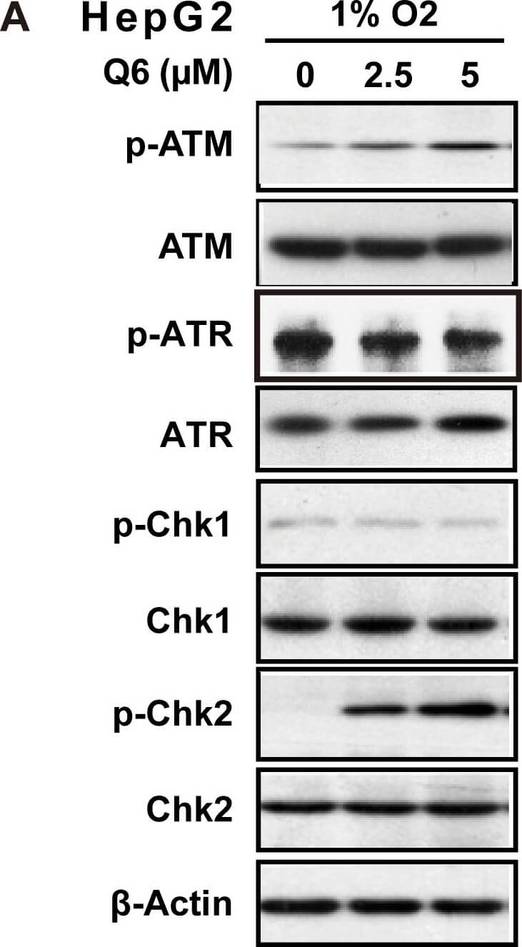 Western Blot of Anti-ATM