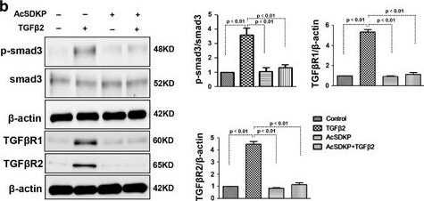 Western Blot of Anti-SMAD3 pS423 pS425