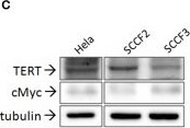 Western Blot of Anti-hTERT