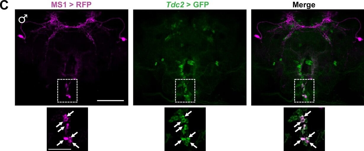 Immunohistochemistry of Anti-RFP