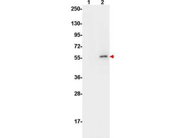 Western Blot using Femtomax