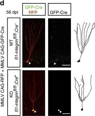 Immunohistochemistry of Anti-RFP