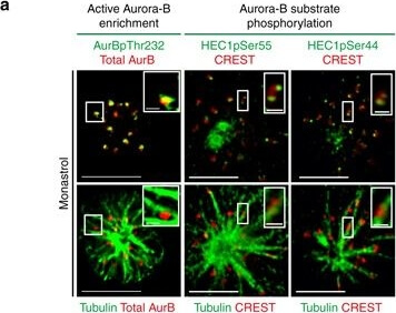 Immunocytochemistry of Anti-Aurora B pT232
