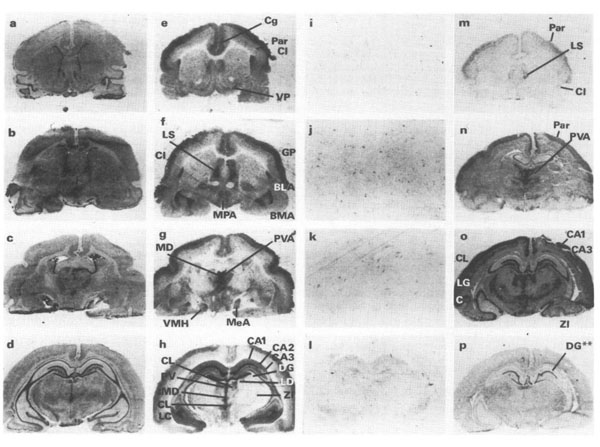 Immunohistochemistry using Guinea Pig Brains