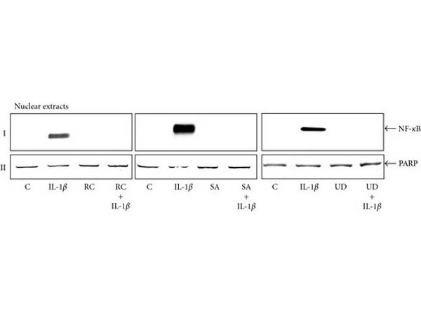 Western Blot of Anti-NFKB p65 pS529 Antibody