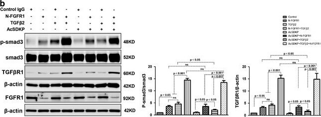Western Blot of Anti-SMAD3 pS423 pS425