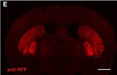 Immunohistochemistry of Anti-RFP