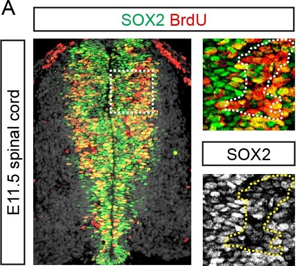 Immunohistochemistry of Anti-BrdU