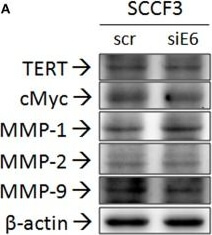 Western Blot of Anti-hTERT