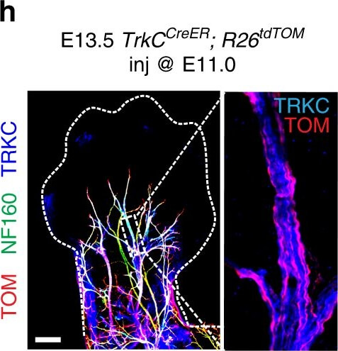 Immunohistochemistry of Chicken Anti-RFP