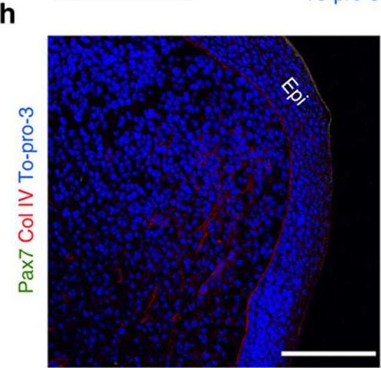 Immunohistochemistry of Anti-Collagen Type IV