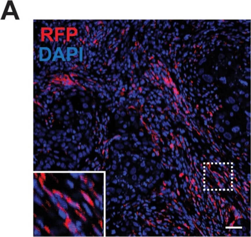 Immunohistochemistry of Goat Anti-RFP