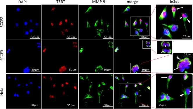 Immunocytochemistry of Anti-hTERT
