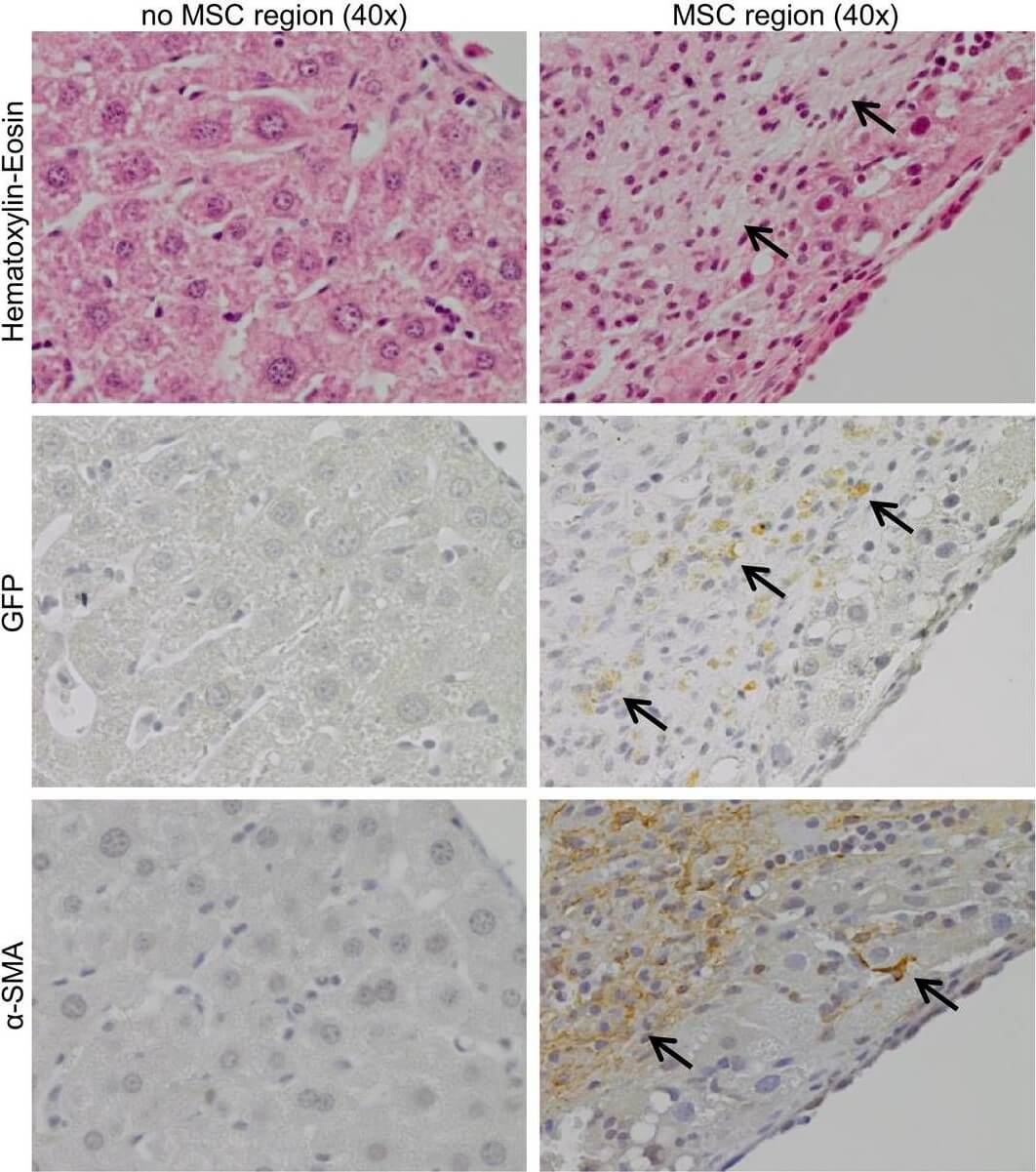 Immunohistochemistry of Anti-GFP