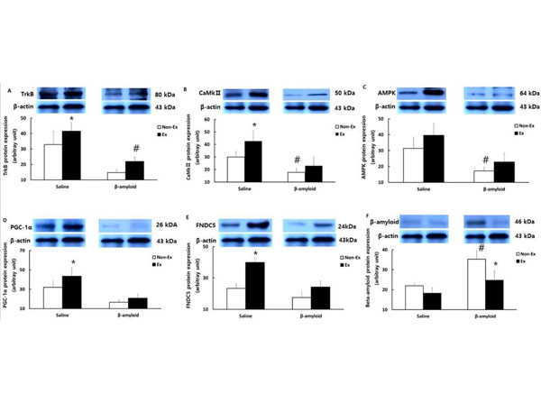 Western Blots using RIPA