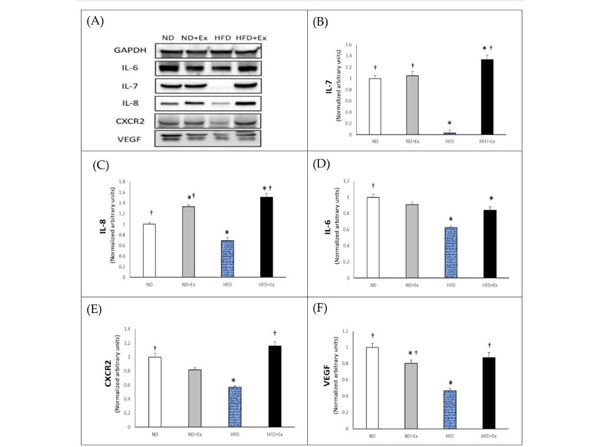 Western Blots using RIPA