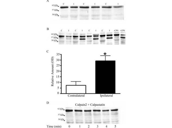 Western Blot using Mouse Brain