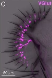 Immunohistochemistry of Anti-RFP