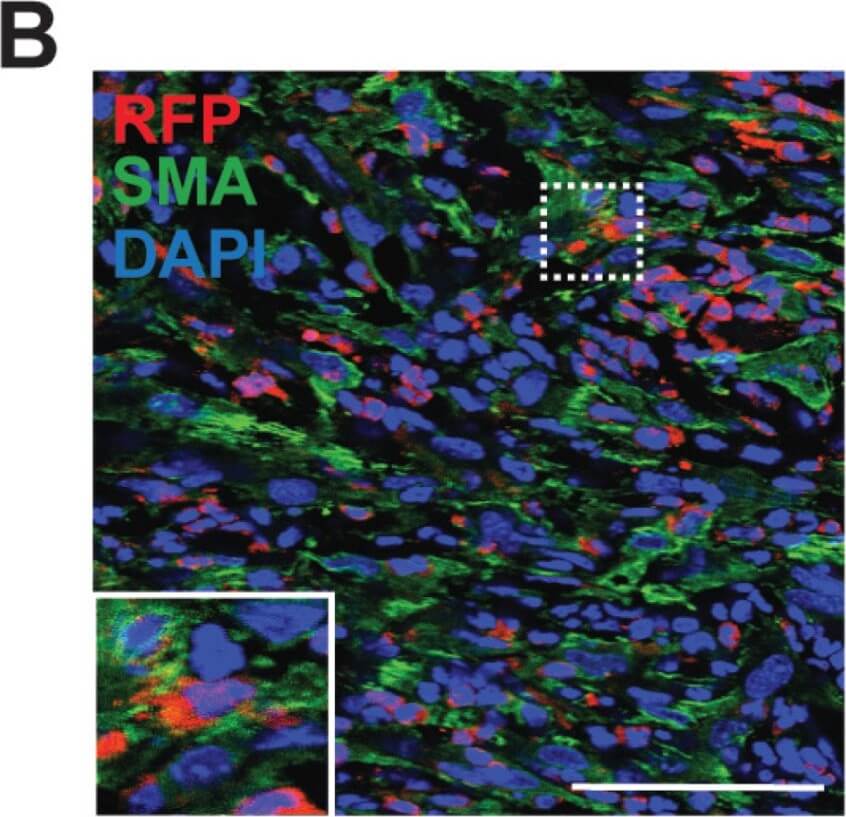 Immunohistochemistry of Goat Anti-RFP