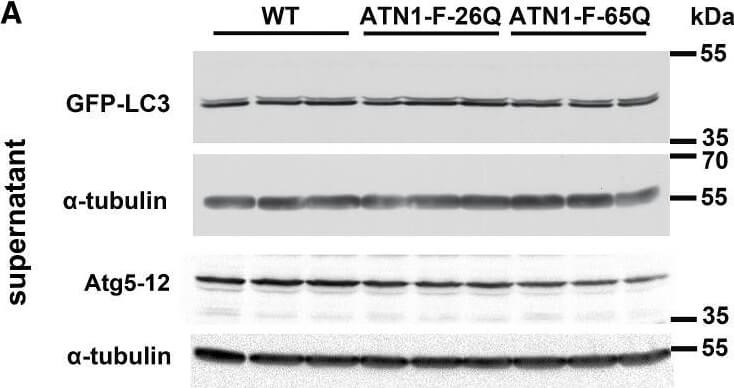 Western Blotting of Anti-ATG13 pS318