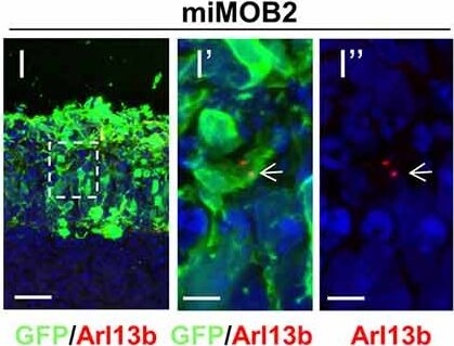 Immunohistochemistry of Anti-RFP