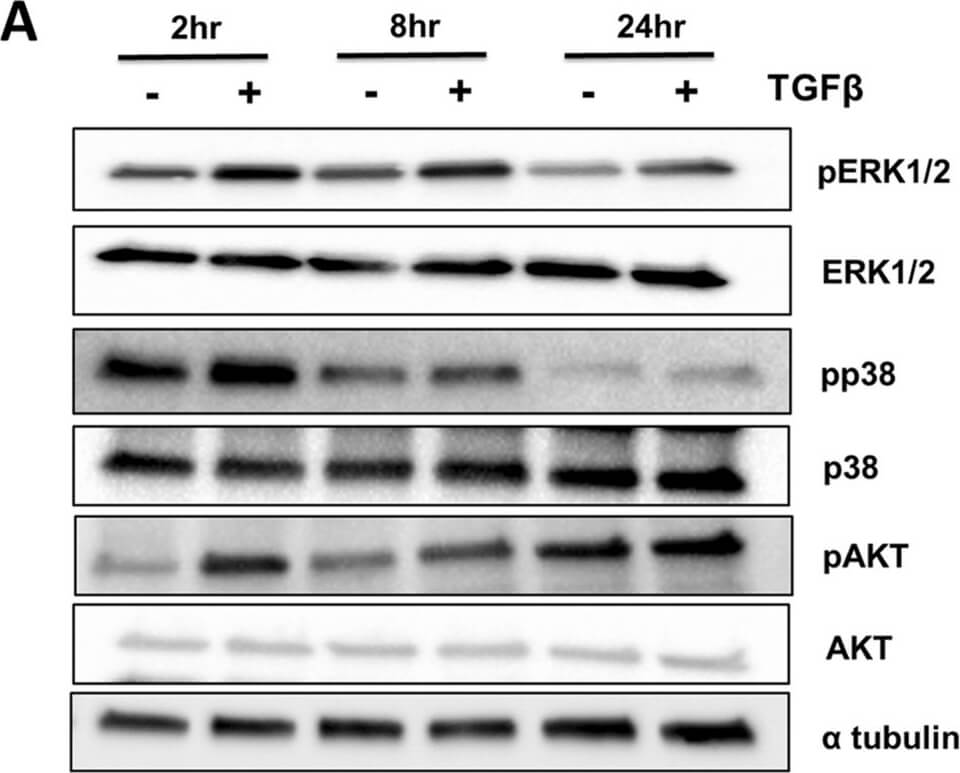Western Blot of Anti-ALPHA-TUBULIN