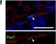 Immunohistochemistry of Anti-Collagen Type IV